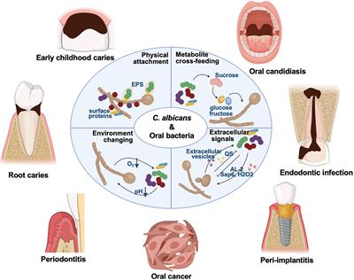 Frontiers Cross Kingdom Interaction Between Candida Albicans And Oral